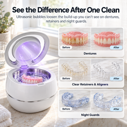 Smilette Ultrasonic Denture & Retainer Cleaner